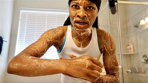 Disgusting Skin Prank On Armon And Trey Prank Videos Pranks Skin
