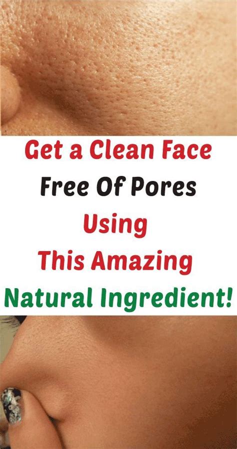 How To Make Pores Disappear With Only 1 Ingredient Naturally Nose