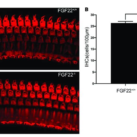 Whole Mount Of The Cochlea Hair Cells In Fgf22 And Fgf22 −−