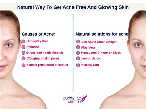 Natural Way To Get Acne Free And Glowing Skin Cosmetics And You