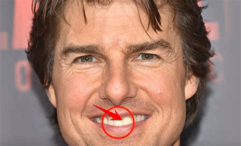 Tom Cruise Teeth And Smile Facts You Need To Know