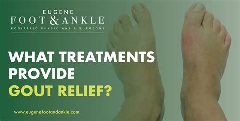 Gout Relief Treatments Eugene Foot And Ankle