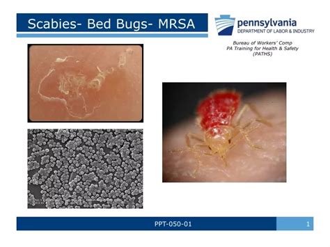 Ppt Scabies Bed Bugs Mrsa Powerpoint Presentation Free Download