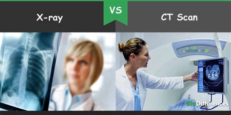 Difference Between X Ray And Ct Scan Bio Differences 7384 The Best