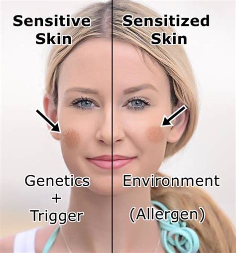 How To Test If Your Skin Is Sensitive