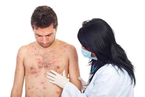Doctor Examine Man Skin Rash Natures Rite