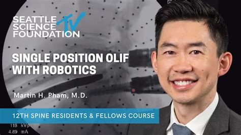 Single Position Olif With Robotics Martin H Pham Md Youtube
