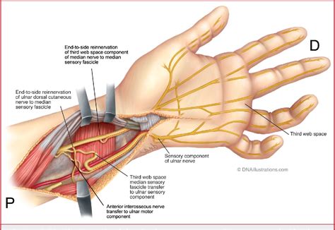 Seriously 31 Facts About Median Nerve Hand Of Benediction It Is One