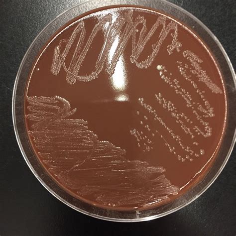 Chocolate Agar Principles Composition Preparation Uses And Colony