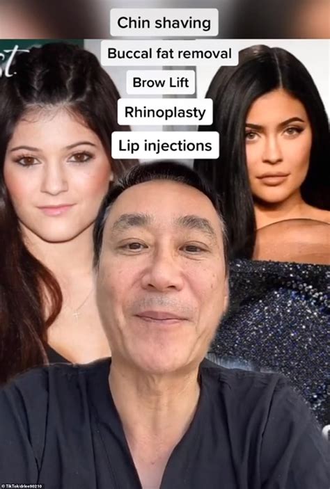 plastic surgeon reveals which a listers from bella hadid to khloé kardashian gone under