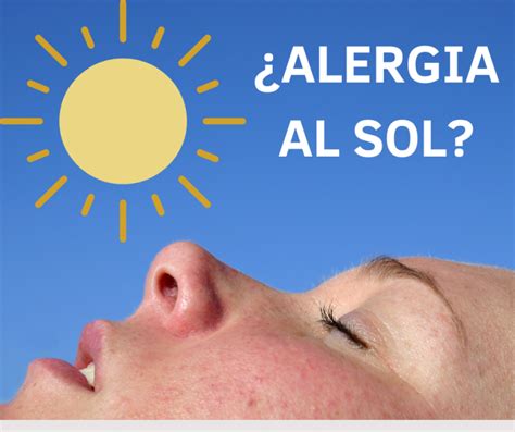 ¿alergia Al Sol Dr Javier Contreras