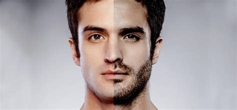 No facial hair. — MediMetry - Consult Doctor Online