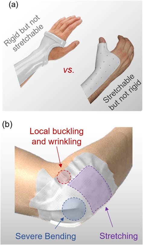 A Bandages That Typically Combine Different Types Of Large