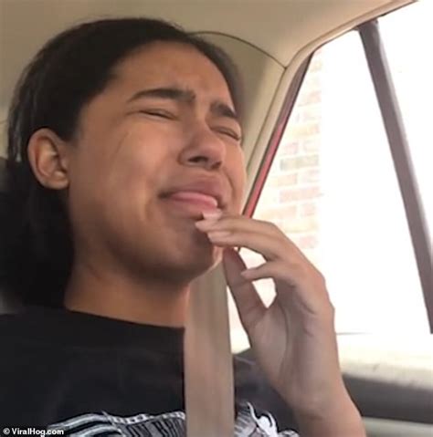 My Tongue Fell Out Girl Freaks Out After Wisdom Teeth Removal In Us