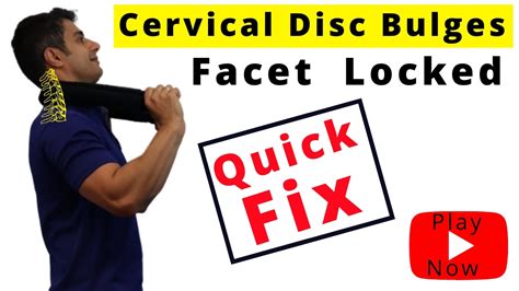 Cervical Disc Bulge And Cervical Facet Lock Pain Relief Dublin Sports