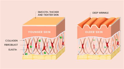 Collagen deficiency? The 6 causes of collagen deficiency | Skin for Skin