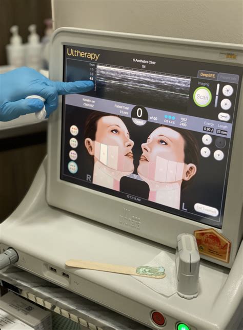 Review Ultherapy — The Gold Standard Treatment For Non Invasive Skin