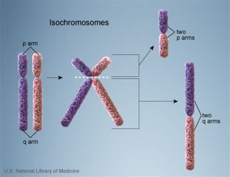 Pallister Killian Mosaic Syndrome Medlineplus Genetics