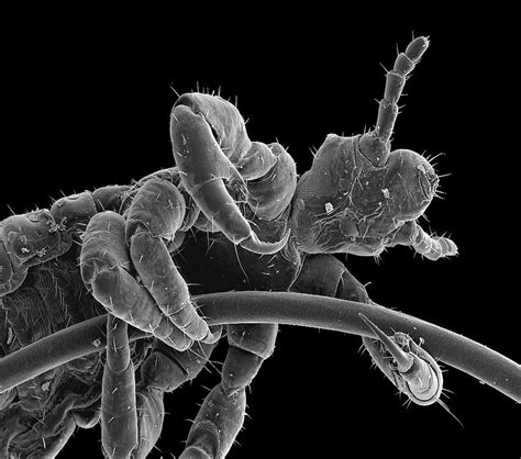 Head Louse Photograph By Steve Gschmeissnerscience Photo Library