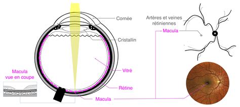 Pathologies Oculaires Les Membranes Epi Rétiniennes Ou Mer Pôle
