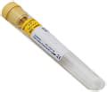 BD 364606 Vacutainer With ACD Solution A Blood Collection Tube Buy