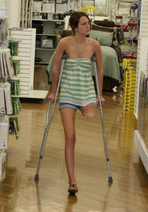 Amputee Ladies On Crutches