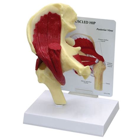 Gpi Anatomicals® Muscled Hip Model