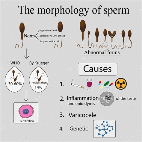 Infographics Sperm Morphology — Stock Vector