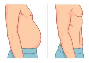 Types Of Belly Fat Risk Factors And Tips To Manage It