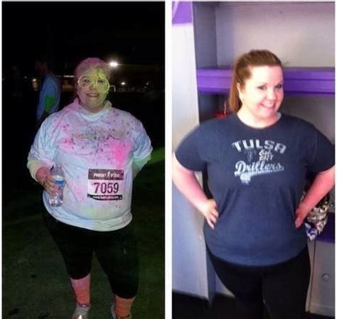 Before And After Pcos Ambers 30 Pound Weight Loss Journey Pcos