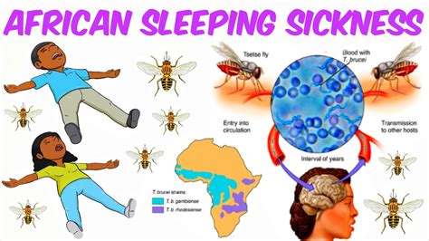 African Sleeping Sickness African Trypanosomiasis Youtube
