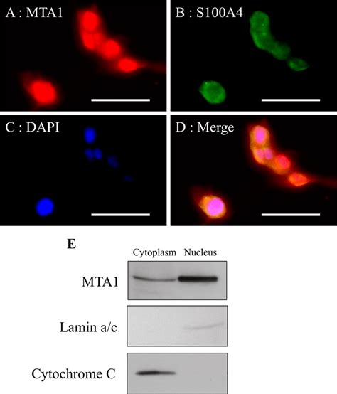 Subcellular Localization Of Mta And S A In Mss Cells Mss Cells