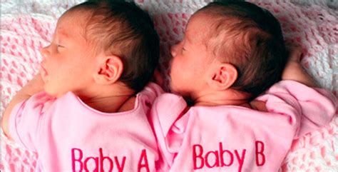10 Incredible True Stories About Twins Listverse