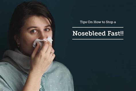 Tips On How To Stop A Nosebleed Fast By Dr Savyasachi Saxena Lybrate