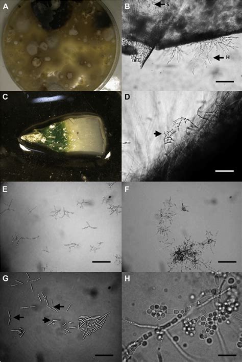 E Images Of Filamentous Fungi Isolated From Cryoconite Sediment A