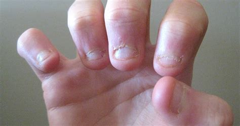 Researchers Reveal What Biting Your Nails Says About Your Personality
