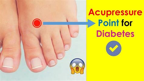 3 Acupressure Points For Diabetes Treat Diabetes Easily And Naturally Youtube