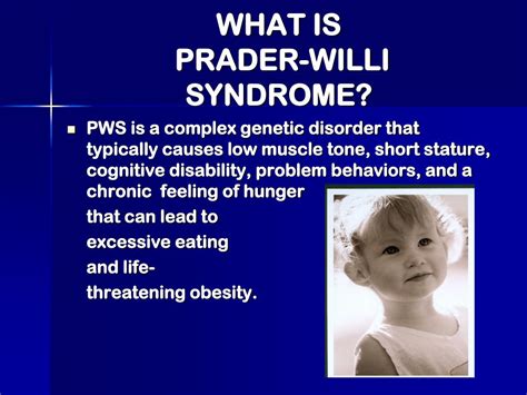 Ppt Living With Prader Willi Syndrome Powerpoint Presentation Free