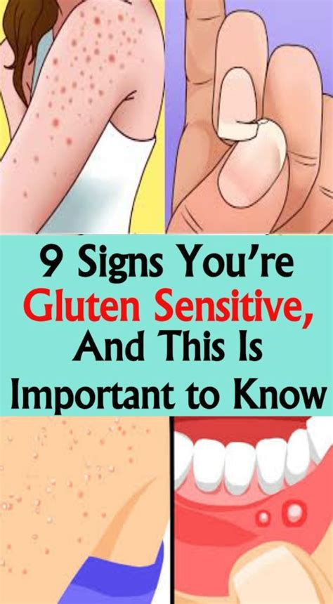 This reaction is characterized by a sudden drop in one's blood pressure, which can lead to unconsciousness. 9 Signs You're Gluten Sensitive, and This Is Important to Know