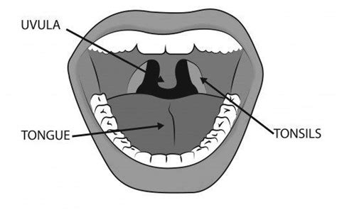 Swollen Uvula Causes Symptoms Treatment And Remedies Swollen Uvula