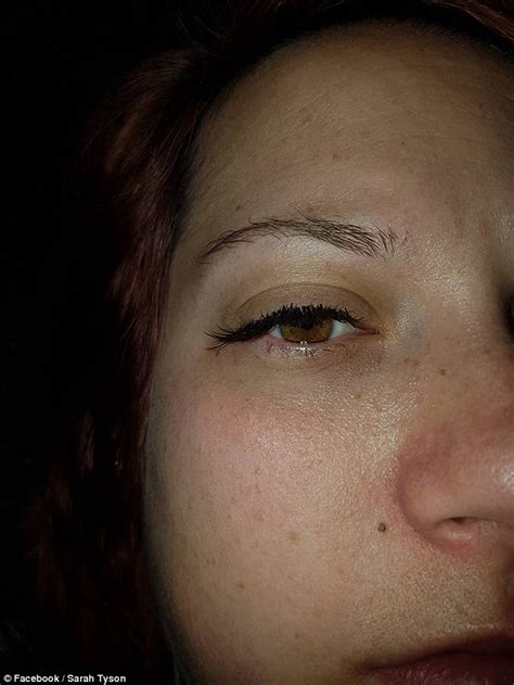 New Zealand Woman Claims Salon Super Glued Her Eyes Shut In Botched