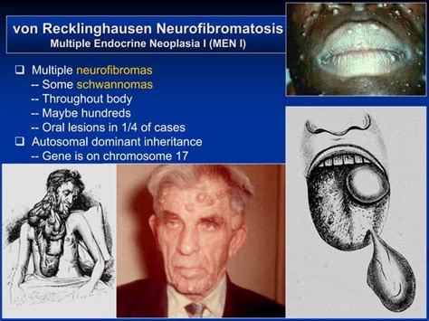 Oral And Maxillofacial Pathology Soft Tissue Tumors 2