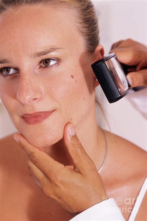 Skin Examination Photograph By Lea Paterson Science Photo Library Fine Art America