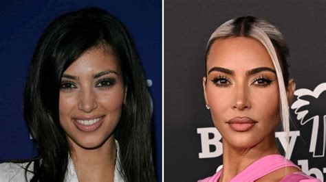 Kim Kardashian Before And After Plastic Surgery Timeline
