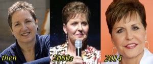 Joyce Meyer Plastic Surgery Before And After Plastic Surgery Hits
