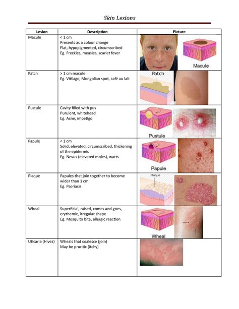 Skin Lesions What Are They Types Causes Diagnosis OFF