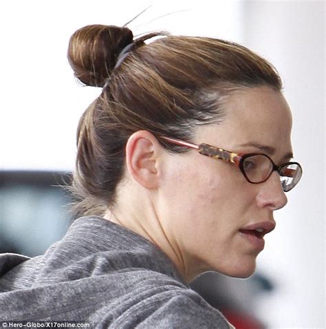 Jennifer Garner Reveals Several Spots On Her Cheek As She Steps Out In