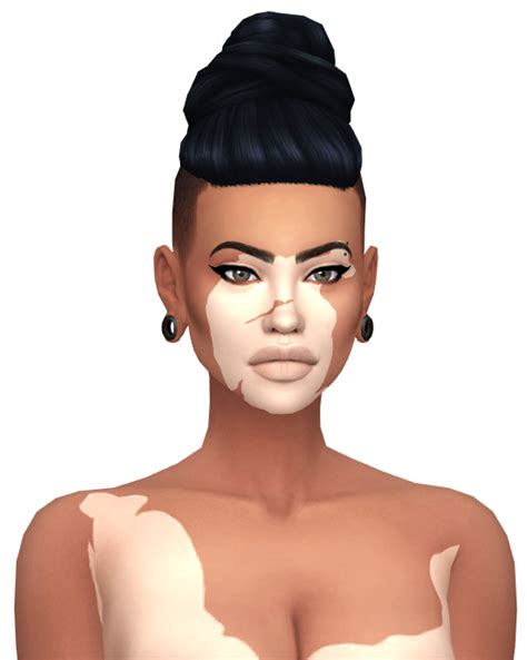 Lana Cc Finds — Ribbontyes Cashs Vitiligo Based On The Sims 4