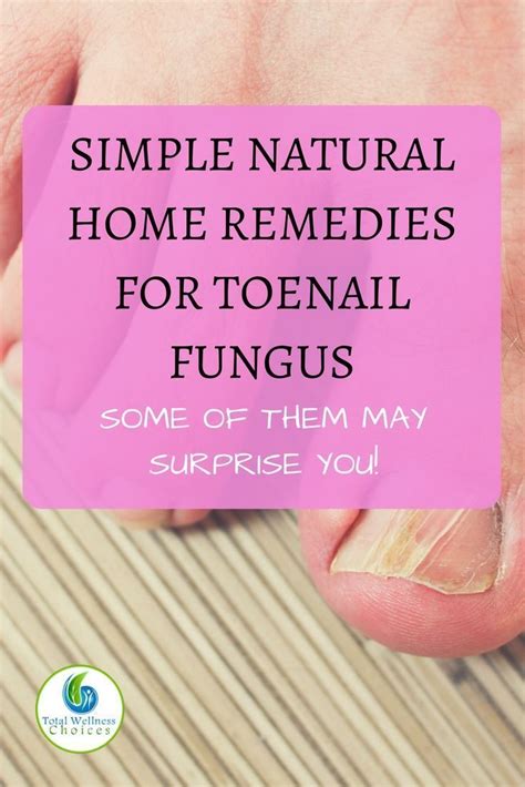9 Simple Natural Home Remedies For Toenail Fungus That May Surprise You