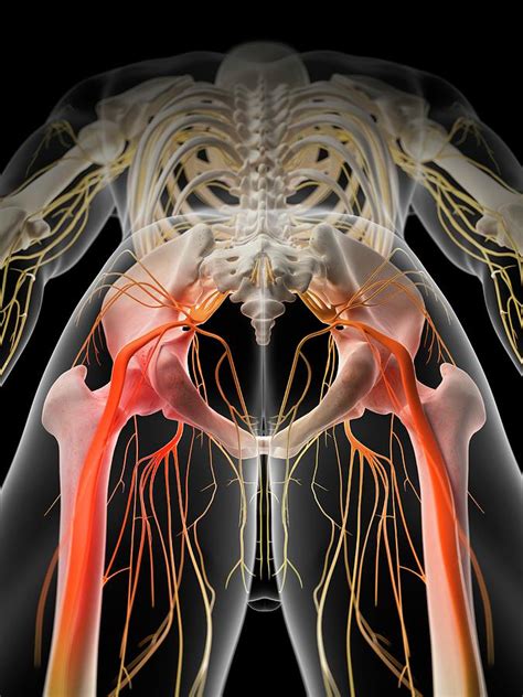 Sciatic Nerve Pain Photograph By Sebastian Kaulitzki Science Photo Library Fine Art America